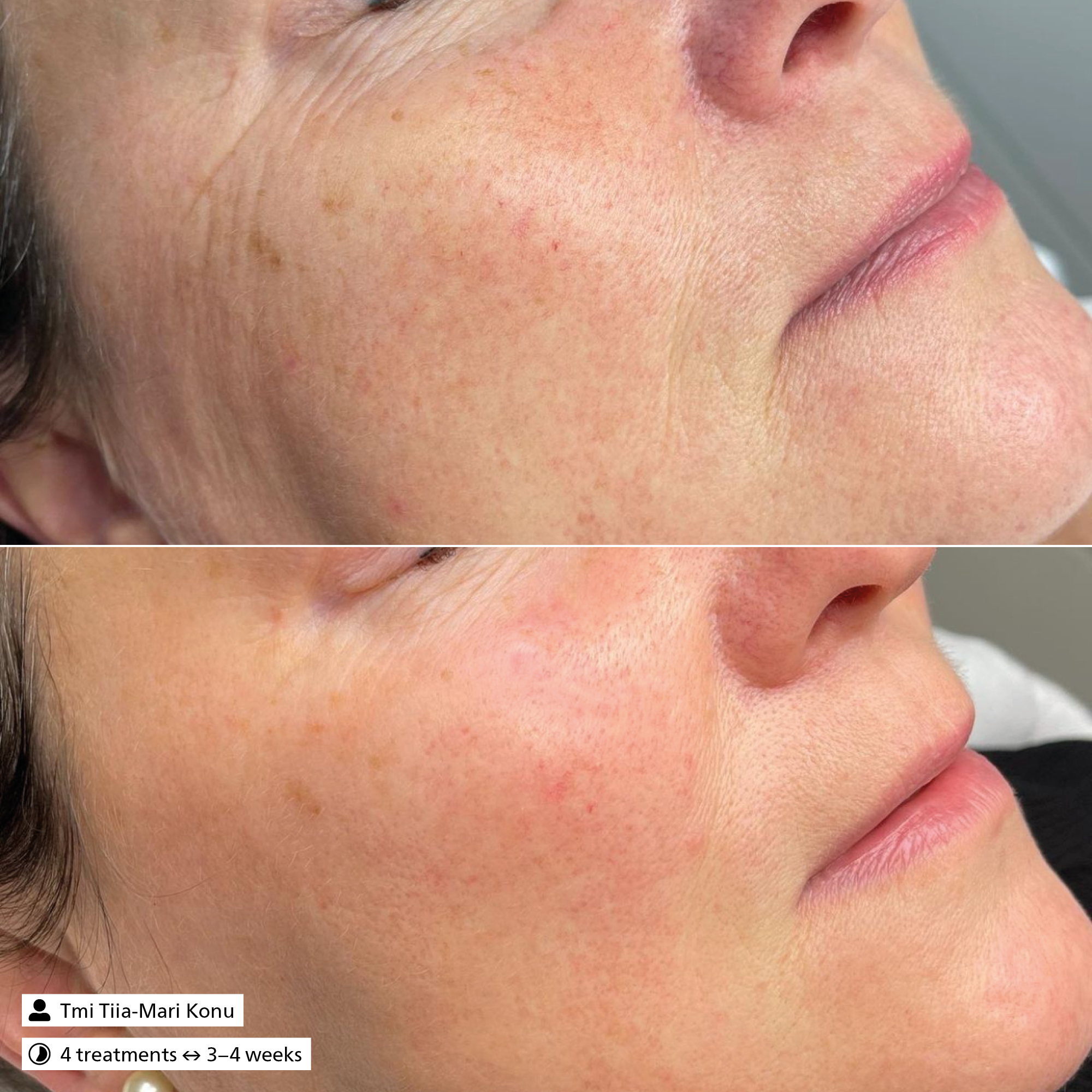Sensitive Skin Tonic
