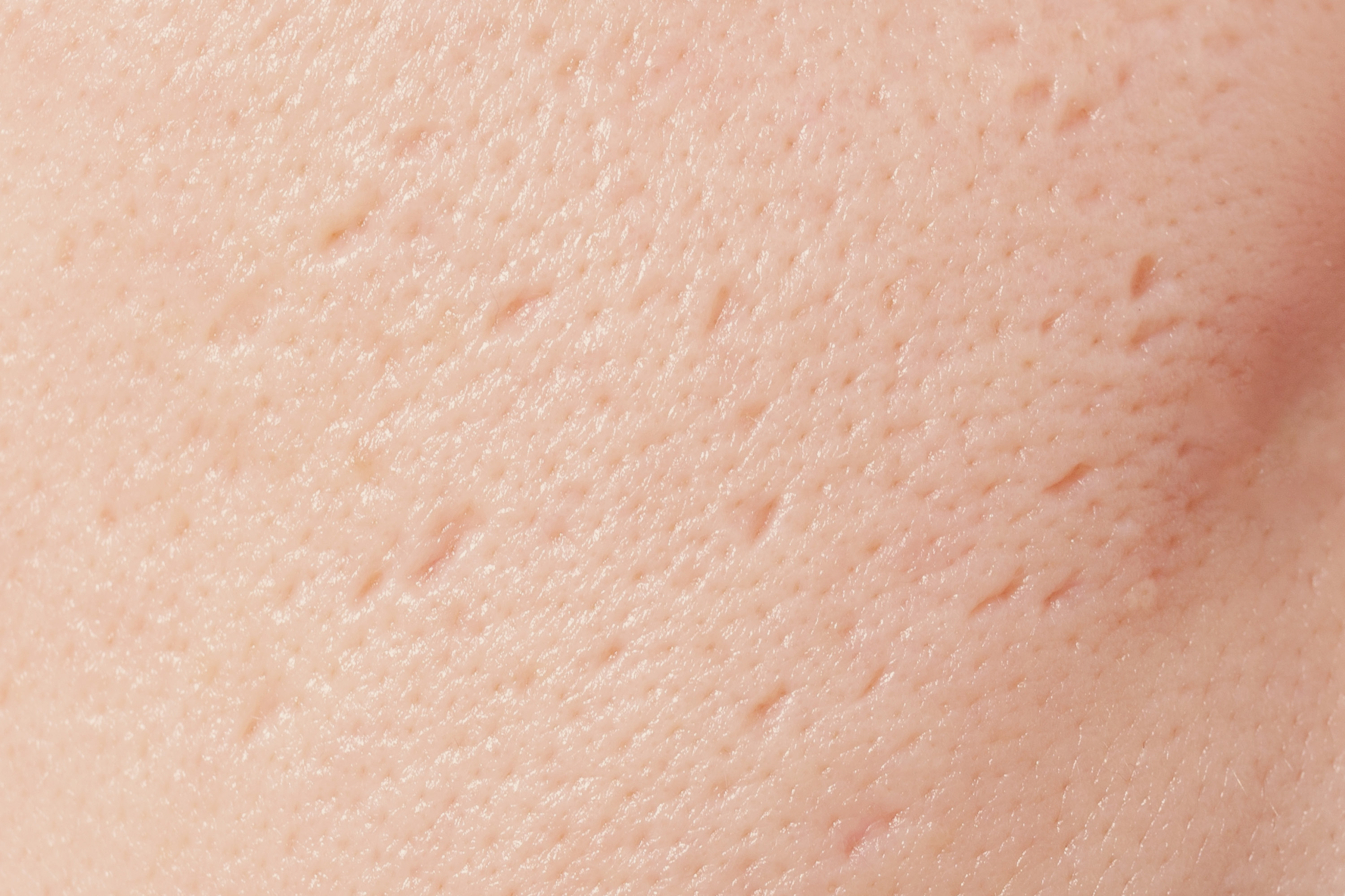 dsr_category_scars_3