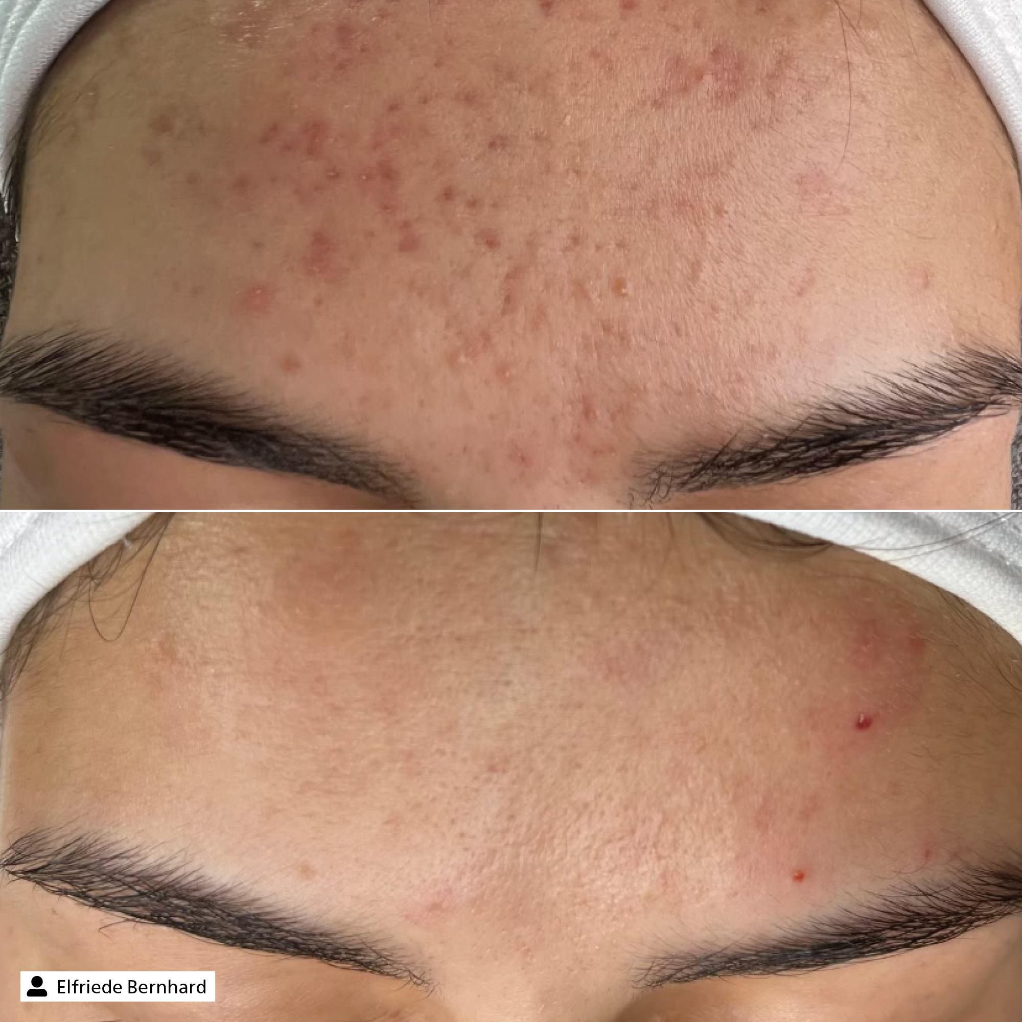 Blemish Control Essence