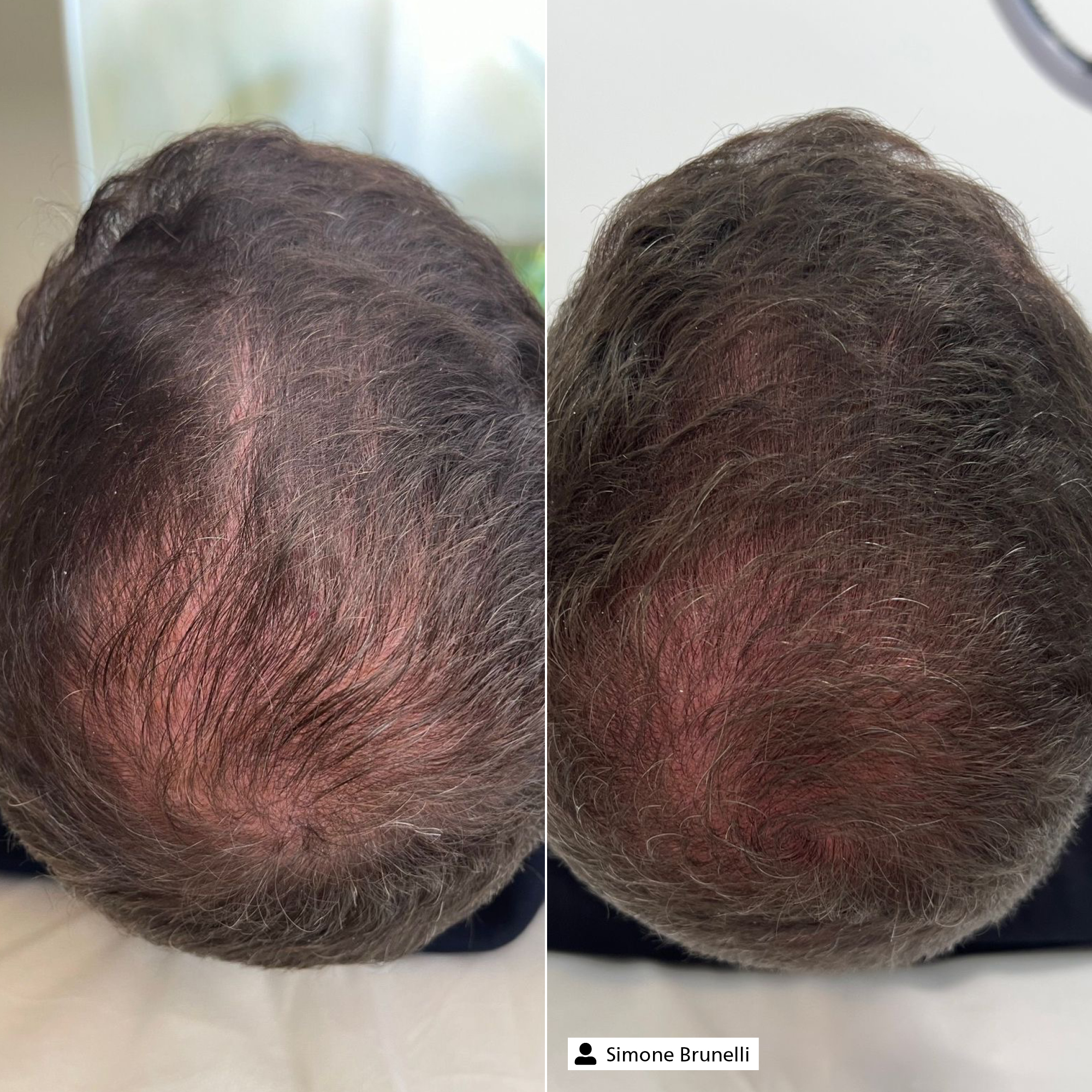 Hair Vitalizer Complex