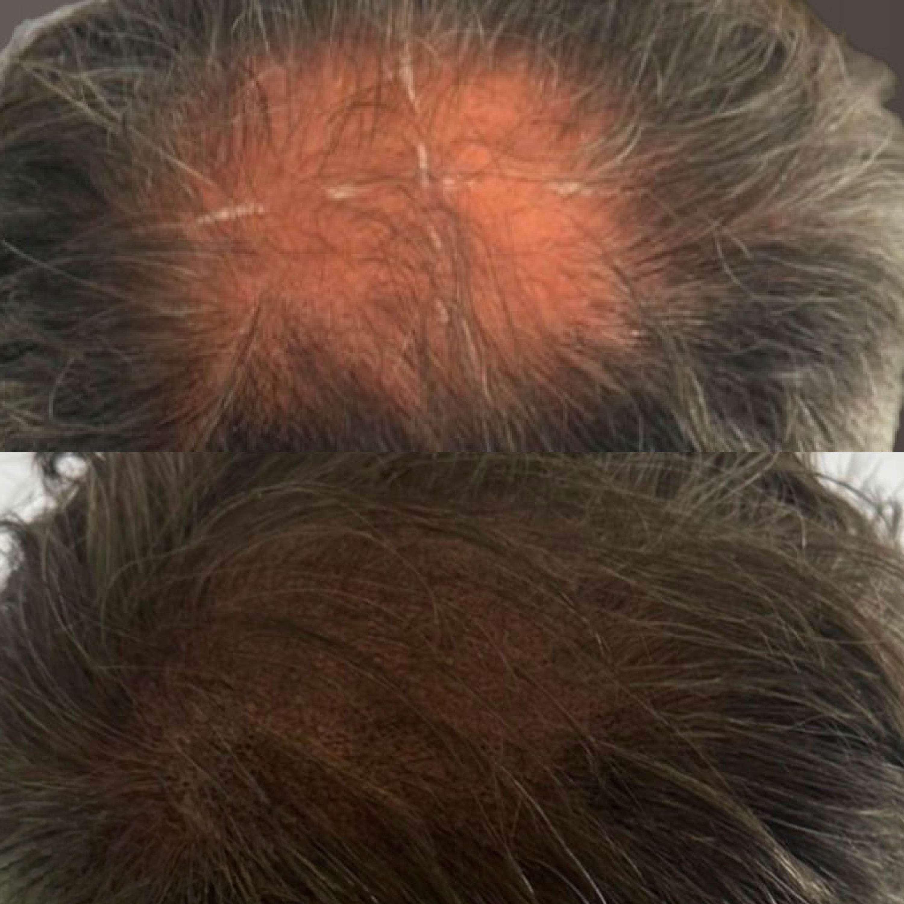 swetlana_keist_scalp