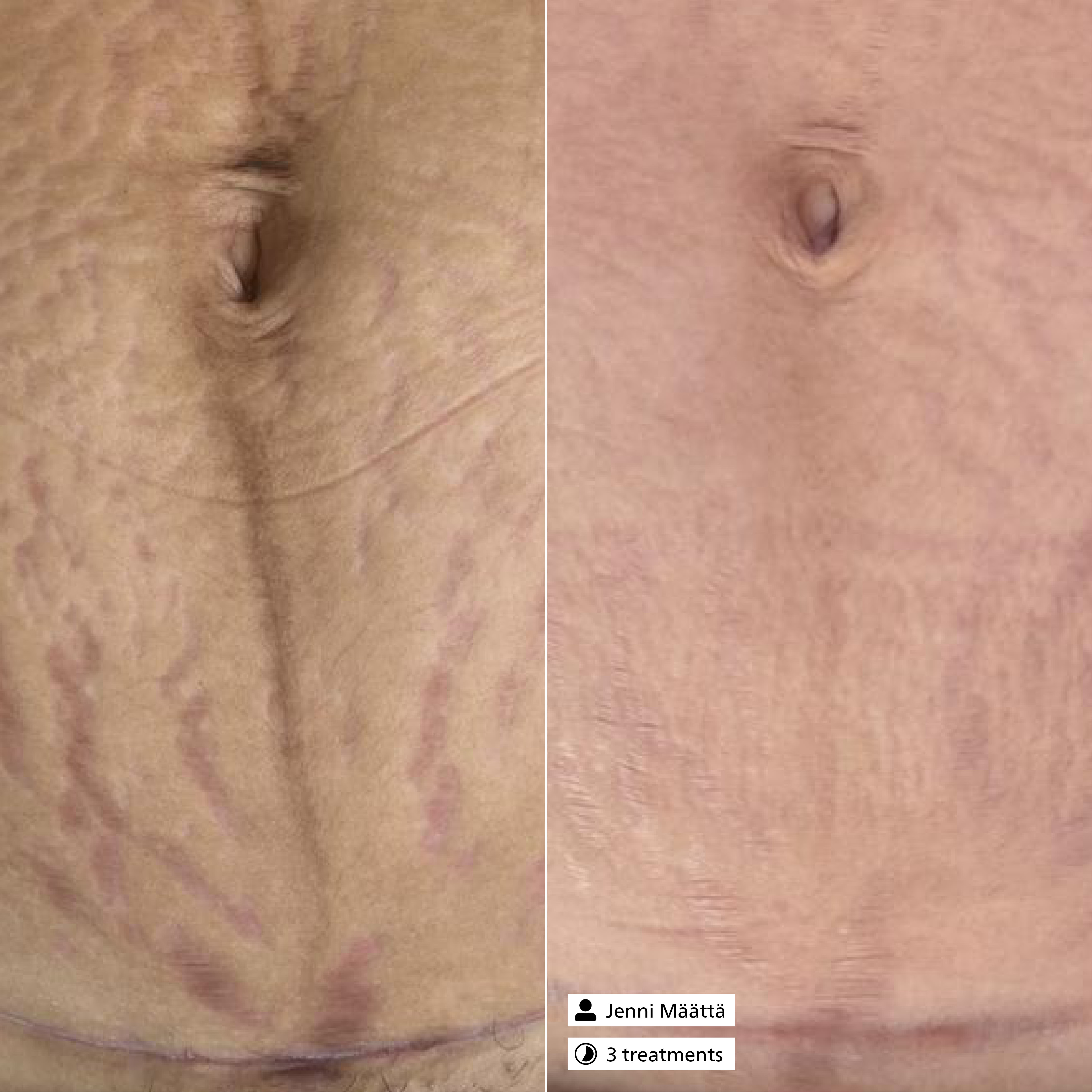 Scar Relaxing Serum