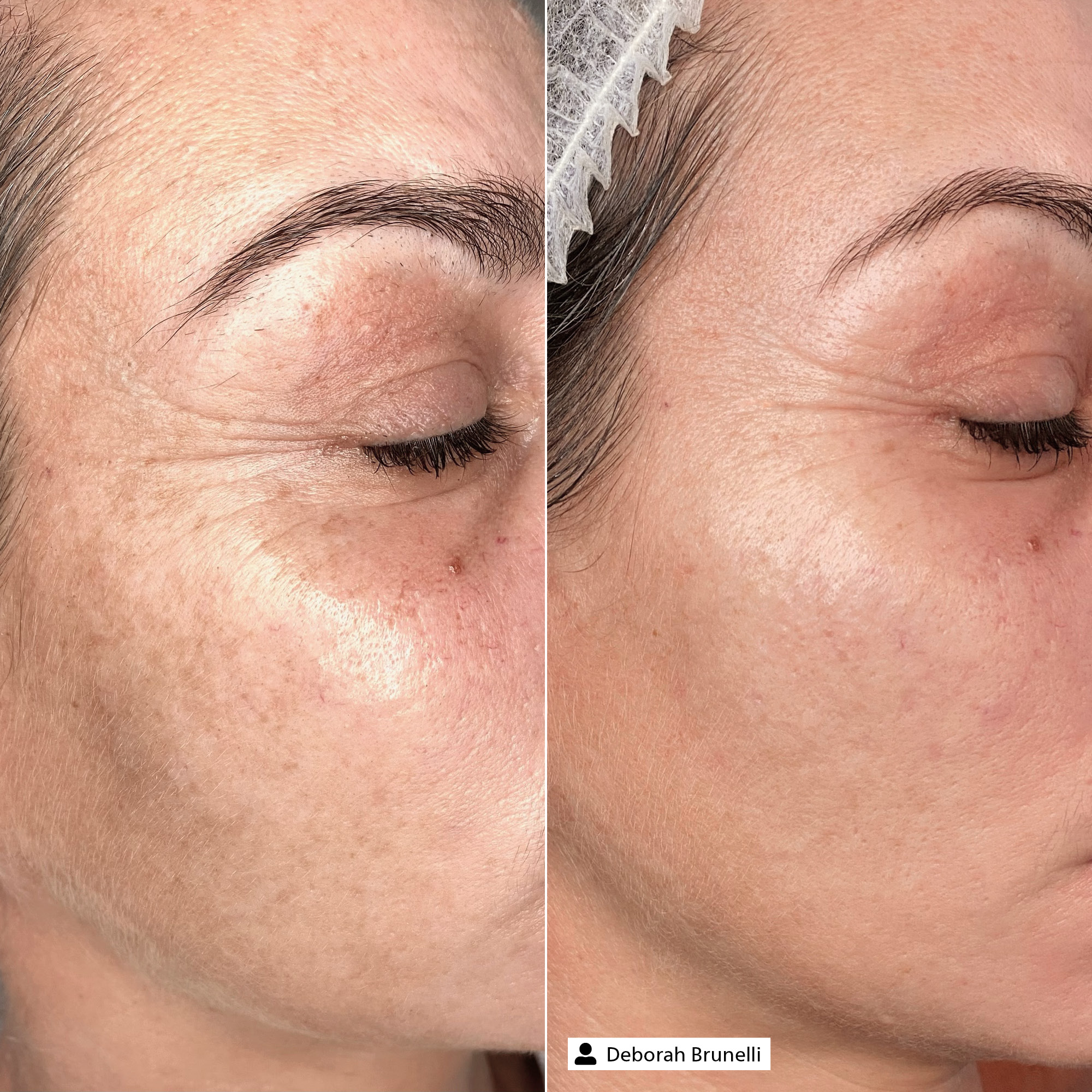 Rich Firming Cream - Sample