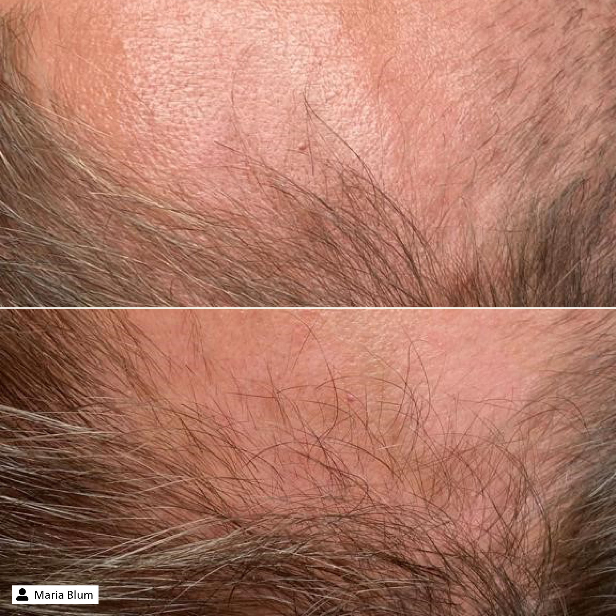 Hair Vitalizer Serum