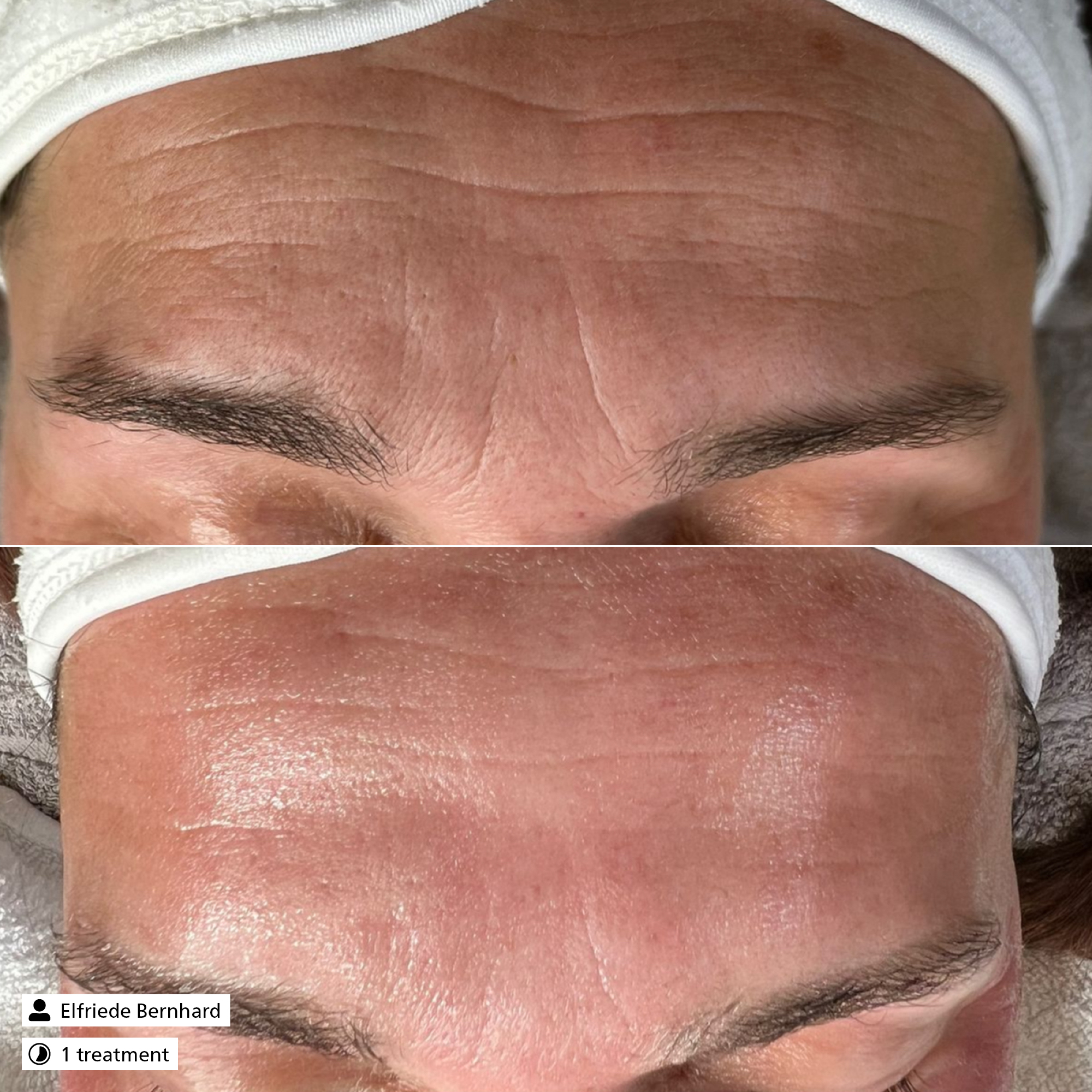 Glycolic Exfoliator 20%