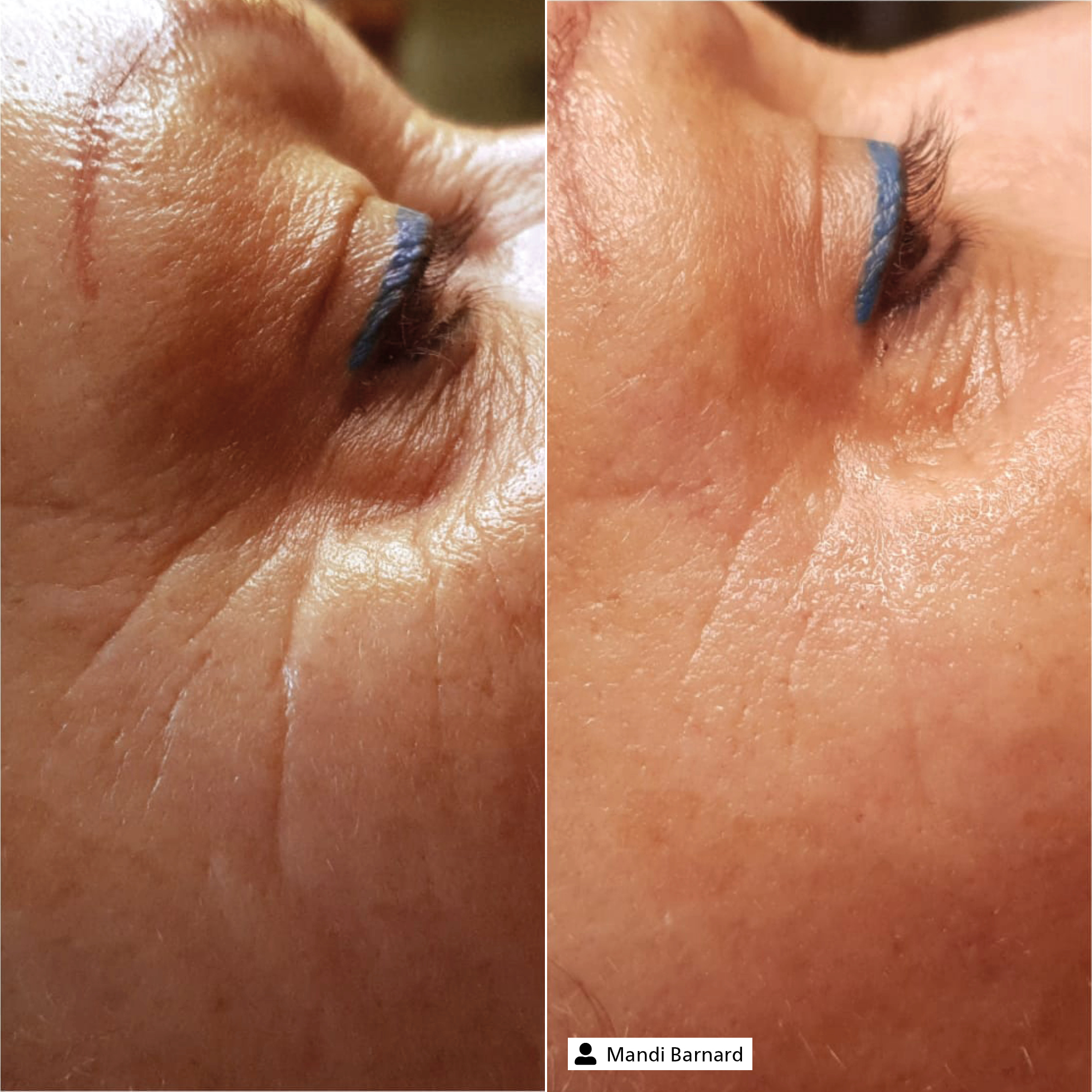 Eye Expert Serum